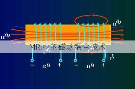 MRI中的磁场耦合技术