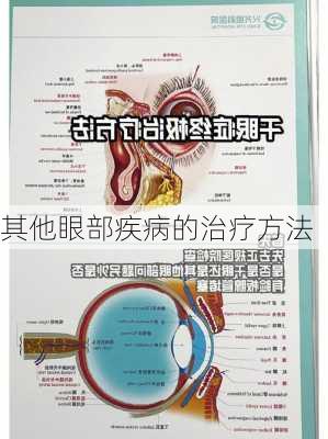 其他眼部疾病的治疗方法