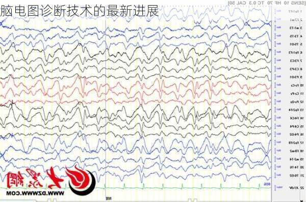 脑电图诊断技术的最新进展