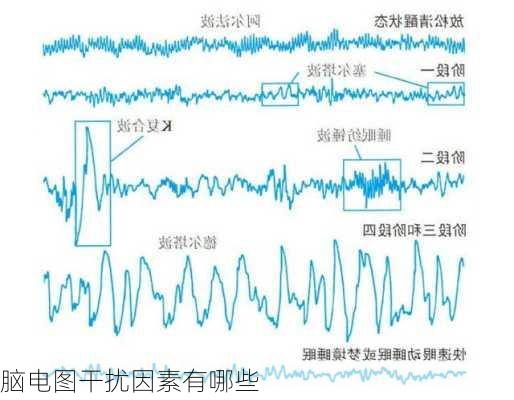 脑电图干扰因素有哪些