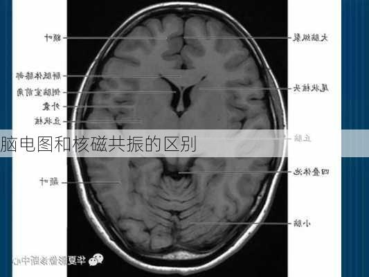 脑电图和核磁共振的区别