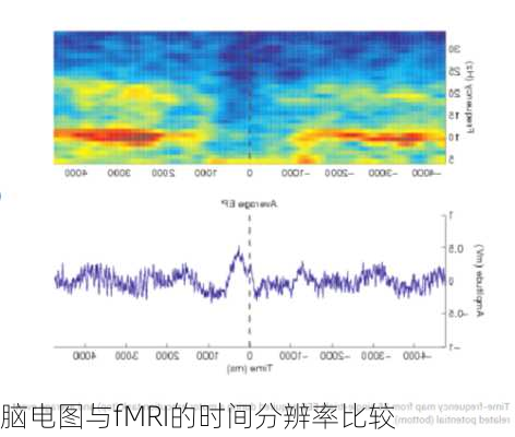 脑电图与fMRI的时间分辨率比较