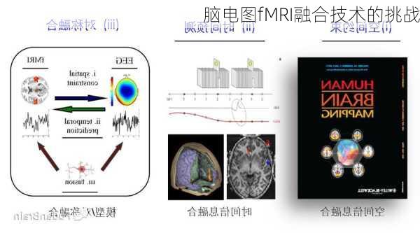 脑电图fMRI融合技术的挑战