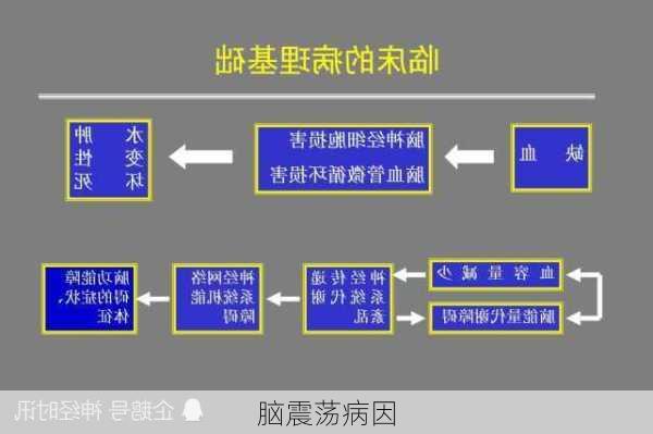 脑震荡病因