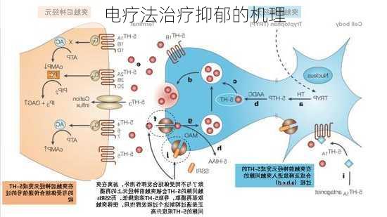 电疗法治疗抑郁的机理