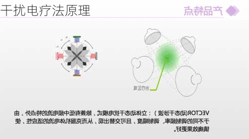 干扰电疗法原理