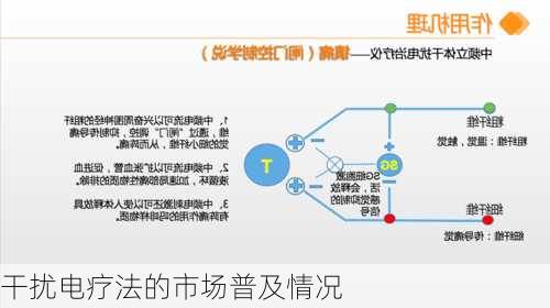 干扰电疗法的市场普及情况