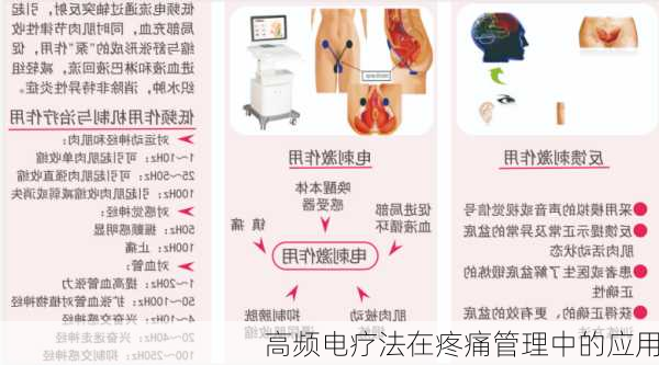 高频电疗法在疼痛管理中的应用