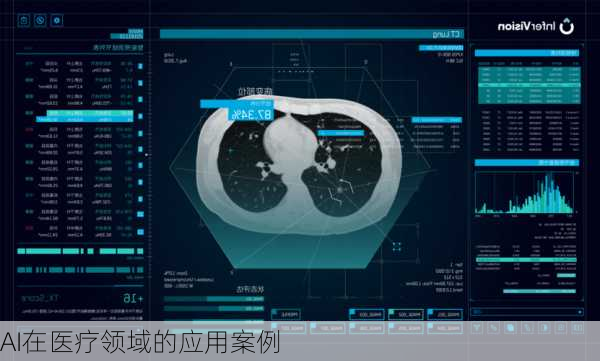 AI在医疗领域的应用案例