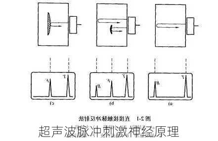 超声波脉冲刺激神经原理