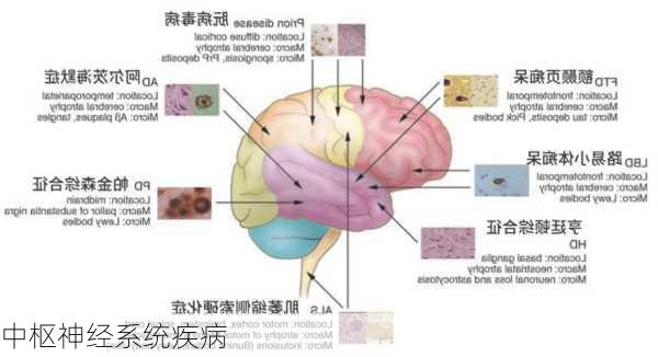 中枢神经系统疾病