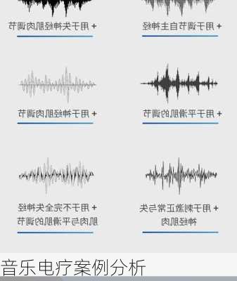 音乐电疗案例分析