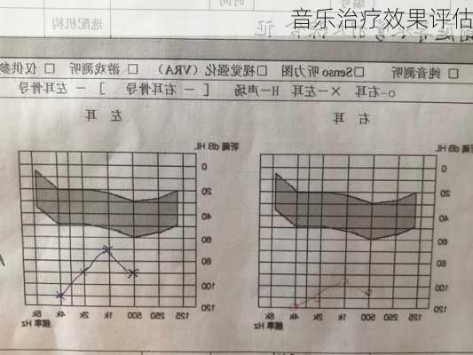 音乐治疗效果评估