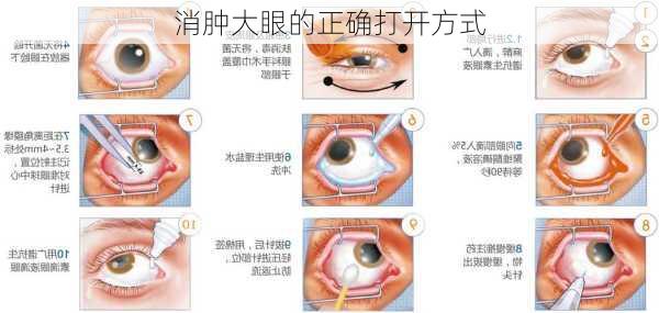 消肿大眼的正确打开方式