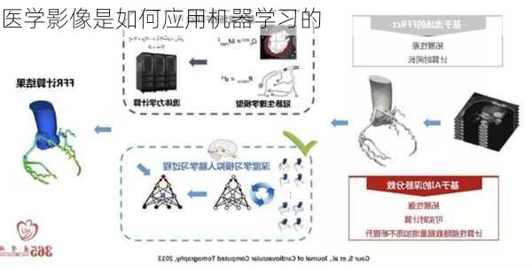 医学影像是如何应用机器学习的