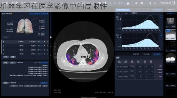 机器学习在医学影像中的局限性