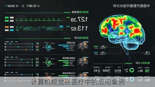 计算机视觉在医疗中的应用案例