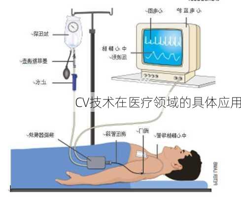 CV技术在医疗领域的具体应用