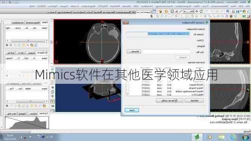 Mimics软件在其他医学领域应用