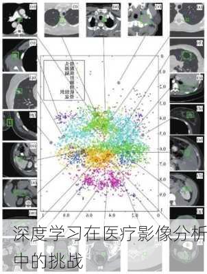 深度学习在医疗影像分析中的挑战