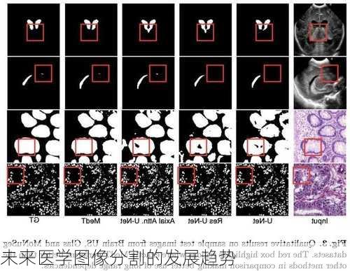 未来医学图像分割的发展趋势