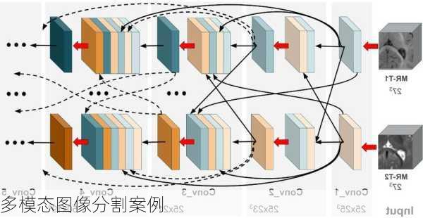 多模态图像分割案例