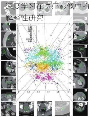 深度学习在医疗影像中的解释性研究