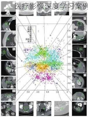 医疗影像深度学习案例