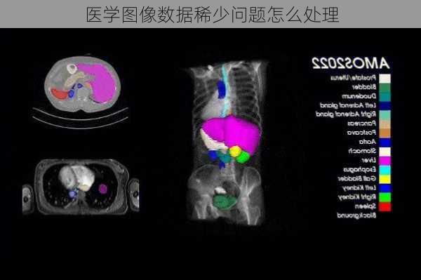 医学图像数据稀少问题怎么处理