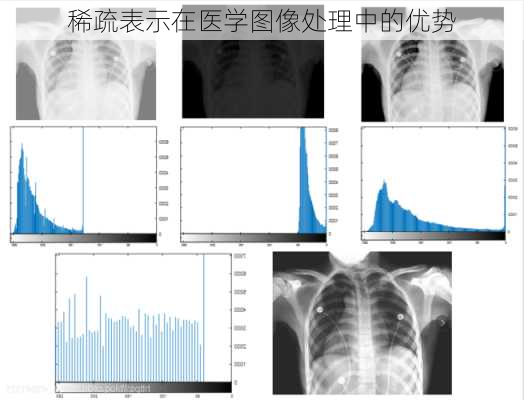 稀疏表示在医学图像处理中的优势