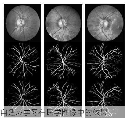 自适应学习在医学图像中的效果