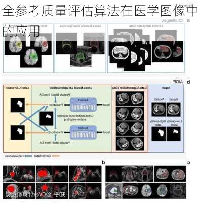 全参考质量评估算法在医学图像中的应用