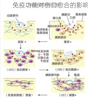 免疫功能对伤口愈合的影响