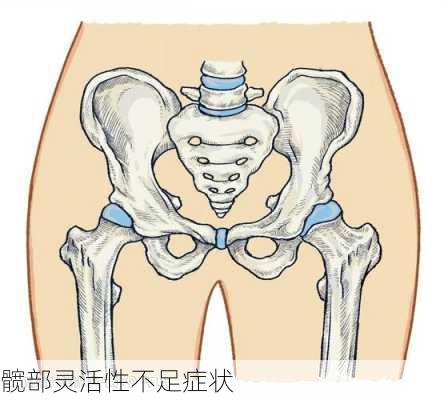 髋部灵活性不足症状