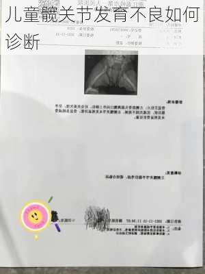 儿童髋关节发育不良如何诊断