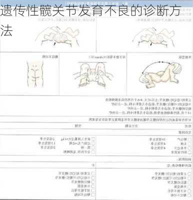 遗传性髋关节发育不良的诊断方法