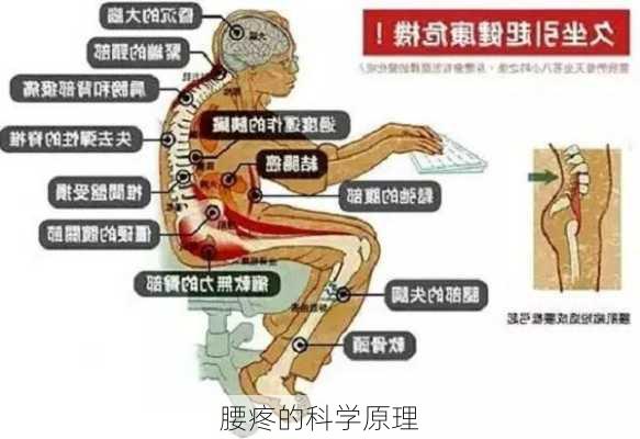 腰疼的科学原理